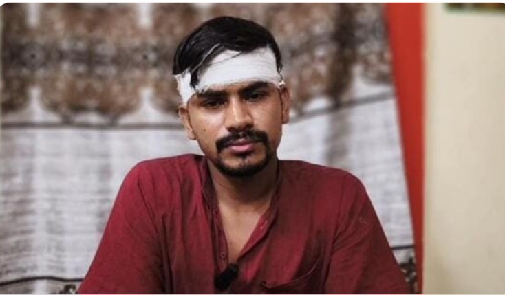 শিলচরে ‘বরাকবাণী’ কার্যালয়ে দুষ্কৃতী হামলা, গুরুতর জখম সংবাদকর্মী রাজু দাস